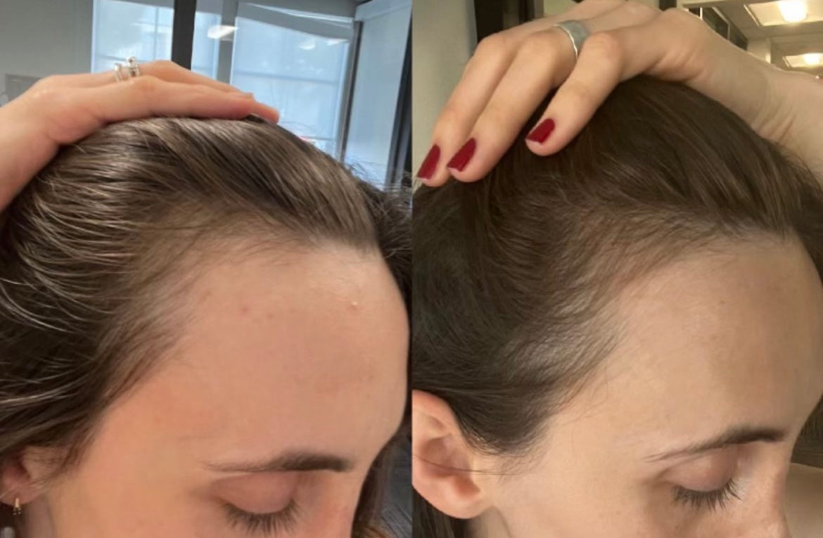Before / after hair growth oil